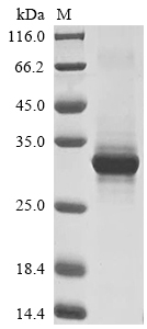 (Tris-Glycine gel) Discontinuous SDS-PAGE (reduced) with 5% enrichment gel and 15% separation gel. (Tris-Glycine gel) Discontinuous SDS-PAGE (reduced) with 5% enrichment gel and 15% separation gel.