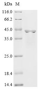 (Tris-Glycine gel) Discontinuous SDS-PAGE (reduced) with 5% enrichment gel and 15% separation gel.