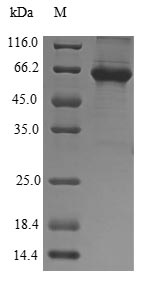 (Tris-Glycine gel) Discontinuous SDS-PAGE (reduced) with 5% enrichment gel and 15% separation gel. (Tris-Glycine gel) Discontinuous SDS-PAGE (reduced) with 5% enrichment gel and 15% separation gel.