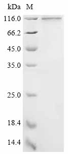 (Tris-Glycine gel) Discontinuous SDS-PAGE (reduced) with 5% enrichment gel and 15% separation gel. (Tris-Glycine gel) Discontinuous SDS-PAGE (reduced) with 5% enrichment gel and 15% separation gel.