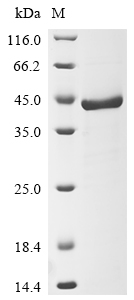 (Tris-Glycine gel) Discontinuous SDS-PAGE (reduced) with 5% enrichment gel and 15% separation gel. (Tris-Glycine gel) Discontinuous SDS-PAGE (reduced) with 5% enrichment gel and 15% separation gel.