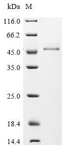 (Tris-Glycine gel) Discontinuous SDS-PAGE (reduced) with 5% enrichment gel and 15% separation gel. (Tris-Glycine gel) Discontinuous SDS-PAGE (reduced) with 5% enrichment gel and 15% separation gel.