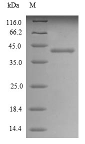 (Tris-Glycine gel) Discontinuous SDS-PAGE (reduced) with 5% enrichment gel and 15% separation gel. (Tris-Glycine gel) Discontinuous SDS-PAGE (reduced) with 5% enrichment gel and 15% separation gel.