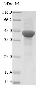 (Tris-Glycine gel) Discontinuous SDS-PAGE (reduced) with 5% enrichment gel and 15% separation gel.