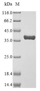 (Tris-Glycine gel) Discontinuous SDS-PAGE (reduced) with 5% enrichment gel and 15% separation gel. (Tris-Glycine gel) Discontinuous SDS-PAGE (reduced) with 5% enrichment gel and 15% separation gel.