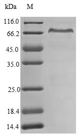 (Tris-Glycine gel) Discontinuous SDS-PAGE (reduced) with 5% enrichment gel and 15% separation gel. (Tris-Glycine gel) Discontinuous SDS-PAGE (reduced) with 5% enrichment gel and 15% separation gel.