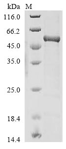 (Tris-Glycine gel) Discontinuous SDS-PAGE (reduced) with 5% enrichment gel and 15% separation gel. (Tris-Glycine gel) Discontinuous SDS-PAGE (reduced) with 5% enrichment gel and 15% separation gel.