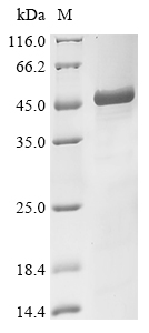 SDS-PAGE- Recombinant protein Human APCS
