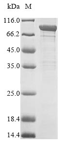SDS-PAGE- Recombinant protein Human APEH