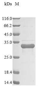 (Tris-Glycine gel) Discontinuous SDS-PAGE (reduced) with 5% enrichment gel and 15% separation gel. (Tris-Glycine gel) Discontinuous SDS-PAGE (reduced) with 5% enrichment gel and 15% separation gel.