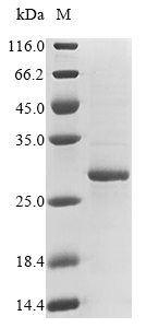 (Tris-Glycine gel) Discontinuous SDS-PAGE (reduced) with 5% enrichment gel and 15% separation gel. (Tris-Glycine gel) Discontinuous SDS-PAGE (reduced) with 5% enrichment gel and 15% separation gel.