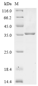 (Tris-Glycine gel) Discontinuous SDS-PAGE (reduced) with 5% enrichment gel and 15% separation gel. (Tris-Glycine gel) Discontinuous SDS-PAGE (reduced) with 5% enrichment gel and 15% separation gel.