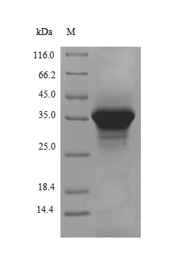 (Tris-Glycine gel) Discontinuous SDS-PAGE (reduced) with 5% enrichment gel and 15% separation gel. (Tris-Glycine gel) Discontinuous SDS-PAGE (reduced) with 5% enrichment gel and 15% separation gel.