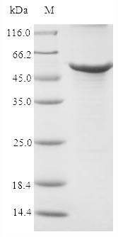 (Tris-Glycine gel) Discontinuous SDS-PAGE (reduced) with 5% enrichment gel and 15% separation gel. (Tris-Glycine gel) Discontinuous SDS-PAGE (reduced) with 5% enrichment gel and 15% separation gel.