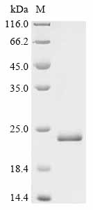 Recombinant Human Androgen receptor (AR) , partial - image 1