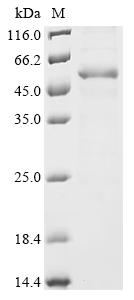Recombinant Human Androgen receptor (AR) , partial - image 1