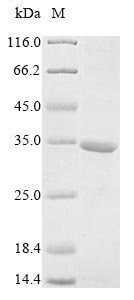 (Tris-Glycine gel) Discontinuous SDS-PAGE (reduced) with 5% enrichment gel and 15% separation gel. (Tris-Glycine gel) Discontinuous SDS-PAGE (reduced) with 5% enrichment gel and 15% separation gel.
