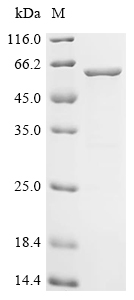 Recombinant Human Actin-related protein 2/3 complex subunit 2 (ARPC2) , partial - image 1