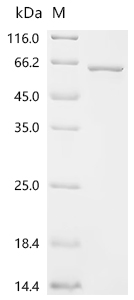 Recombinant Human Arylsulfatase B (ARSB) - image 1