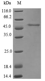 (Tris-Glycine gel) Discontinuous SDS-PAGE (reduced) with 5% enrichment gel and 15% separation gel.