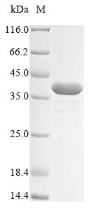 (Tris-Glycine gel) Discontinuous SDS-PAGE (reduced) with 5% enrichment gel and 15% separation gel.