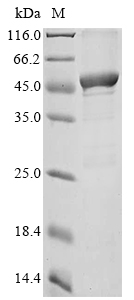 (Tris-Glycine gel) Discontinuous SDS-PAGE (reduced) with 5% enrichment gel and 15% separation gel. (Tris-Glycine gel) Discontinuous SDS-PAGE (reduced) with 5% enrichment gel and 15% separation gel.