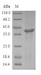 (Tris-Glycine gel) Discontinuous SDS-PAGE (reduced) with 5% enrichment gel and 15% separation gel. (Tris-Glycine gel) Discontinuous SDS-PAGE (reduced) with 5% enrichment gel and 15% separation gel.