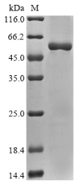 (Tris-Glycine gel) Discontinuous SDS-PAGE (reduced) with 5% enrichment gel and 15% separation gel.
