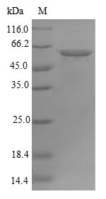 (Tris-Glycine gel) Discontinuous SDS-PAGE (reduced) with 5% enrichment gel and 15% separation gel. (Tris-Glycine gel) Discontinuous SDS-PAGE (reduced) with 5% enrichment gel and 15% separation gel.