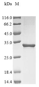 (Tris-Glycine gel) Discontinuous SDS-PAGE (reduced) with 5% enrichment gel and 15% separation gel. (Tris-Glycine gel) Discontinuous SDS-PAGE (reduced) with 5% enrichment gel and 15% separation gel.