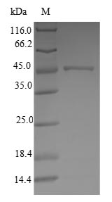 (Tris-Glycine gel) Discontinuous SDS-PAGE (reduced) with 5% enrichment gel and 15% separation gel. (Tris-Glycine gel) Discontinuous SDS-PAGE (reduced) with 5% enrichment gel and 15% separation gel.