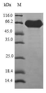 (Tris-Glycine gel) Discontinuous SDS-PAGE (reduced) with 5% enrichment gel and 15% separation gel. (Tris-Glycine gel) Discontinuous SDS-PAGE (reduced) with 5% enrichment gel and 15% separation gel.