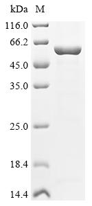Recombinant Human V-type proton ATPase subunit B, brain isoform (ATP6V1B2) - image 1
