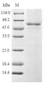 (Tris-Glycine gel) Discontinuous SDS-PAGE (reduced) with 5% enrichment gel and 15% separation gel.
