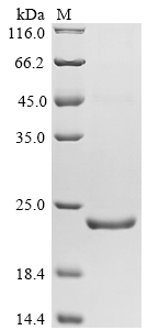 (Tris-Glycine gel) Discontinuous SDS-PAGE (reduced) with 5% enrichment gel and 15% separation gel. (Tris-Glycine gel) Discontinuous SDS-PAGE (reduced) with 5% enrichment gel and 15% separation gel.