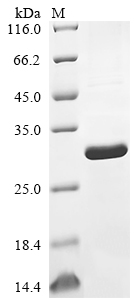 (Tris-Glycine gel) Discontinuous SDS-PAGE (reduced) with 5% enrichment gel and 15% separation gel. (Tris-Glycine gel) Discontinuous SDS-PAGE (reduced) with 5% enrichment gel and 15% separation gel.