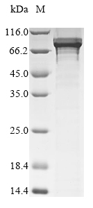 (Tris-Glycine gel) Discontinuous SDS-PAGE (reduced) with 5% enrichment gel and 15% separation gel. (Tris-Glycine gel) Discontinuous SDS-PAGE (reduced) with 5% enrichment gel and 15% separation gel.