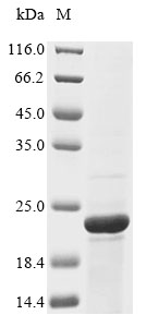 Recombinant Chicken Osteocalcin (BGLAP) - image 1