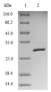 SDS-PAGE- Recombinant protein Human BIRC5