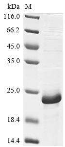 (Tris-Glycine gel) Discontinuous SDS-PAGE (reduced) with 5% enrichment gel and 15% separation gel. (Tris-Glycine gel) Discontinuous SDS-PAGE (reduced) with 5% enrichment gel and 15% separation gel.