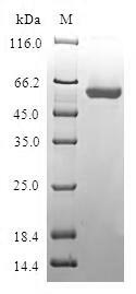 (Tris-Glycine gel) Discontinuous SDS-PAGE (reduced) with 5% enrichment gel and 15% separation gel. (Tris-Glycine gel) Discontinuous SDS-PAGE (reduced) with 5% enrichment gel and 15% separation gel.