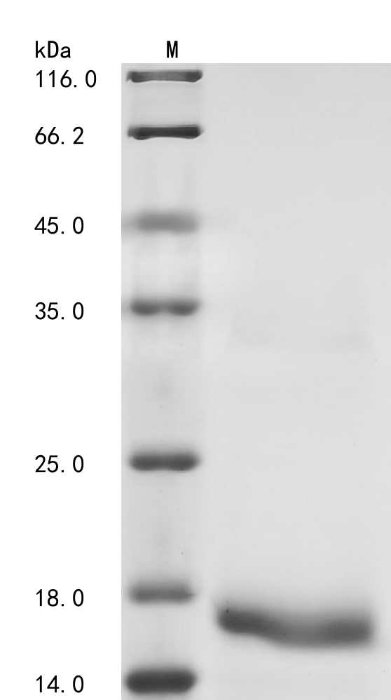 (Tris-Glycine gel) Discontinuous SDS-PAGE (reduced) with 5% enrichment gel and 15% separation gel. (Tris-Glycine gel) Discontinuous SDS-PAGE (reduced) with 5% enrichment gel and 15% separation gel.