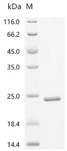 Recombinant Human Bromodomain-containing protein 2 (BRD2) , partial - image 1