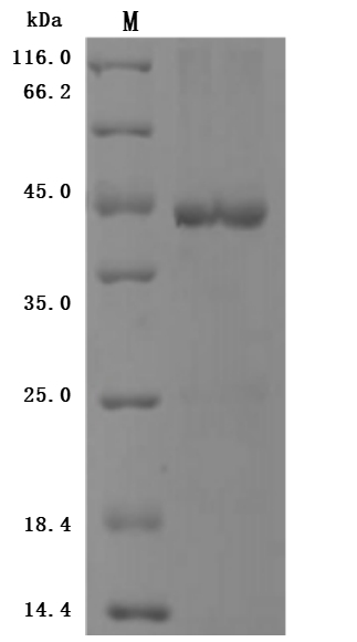 Recombinant Human Bromodomain-containing protein 4 (BRD4) , partial - image 1