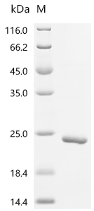 Recombinant Human Bromodomain-containing protein 4 (BRD4) , partial - image 1