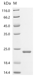 Recombinant Human Bromodomain-containing protein 4 (BRD4) , partial - image 1