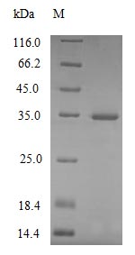 (Tris-Glycine gel) Discontinuous SDS-PAGE (reduced) with 5% enrichment gel and 15% separation gel. (Tris-Glycine gel) Discontinuous SDS-PAGE (reduced) with 5% enrichment gel and 15% separation gel.
