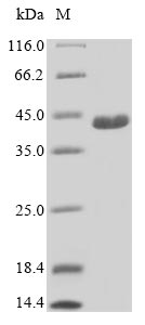 (Tris-Glycine gel) Discontinuous SDS-PAGE (reduced) with 5% enrichment gel and 15% separation gel. (Tris-Glycine gel) Discontinuous SDS-PAGE (reduced) with 5% enrichment gel and 15% separation gel.