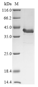 (Tris-Glycine gel) Discontinuous SDS-PAGE (reduced) with 5% enrichment gel and 15% separation gel. (Tris-Glycine gel) Discontinuous SDS-PAGE (reduced) with 5% enrichment gel and 15% separation gel.