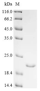 Recombinant Mouse C5a anaphylatoxin chemotactic receptor (C5ar1) , partial - image 1